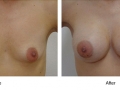 Case-2