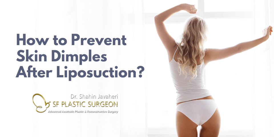 skin dimples after liposuction